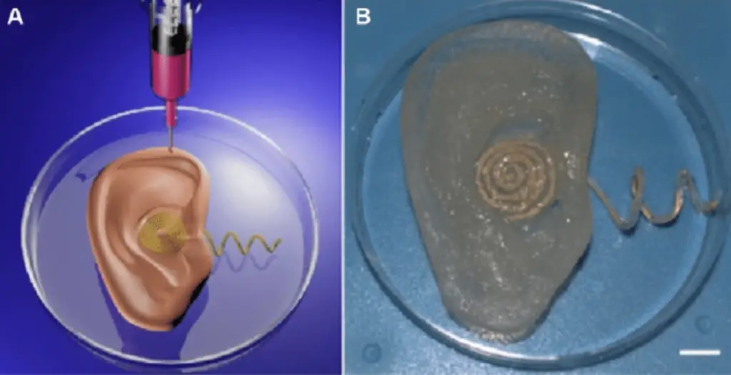 How Is Ionic Ear Different From Similar Implants?